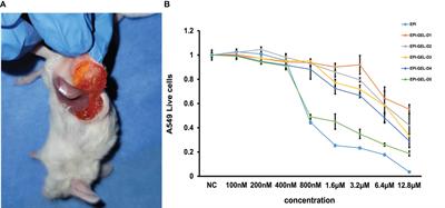 Study of epirubicin sustained–release chemoablation in tumor suppression and tumor microenvironment remodeling